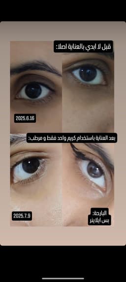 اول كريم عين استعملته لهلات عيوني و راح اشارك صوره وانتو حكمو