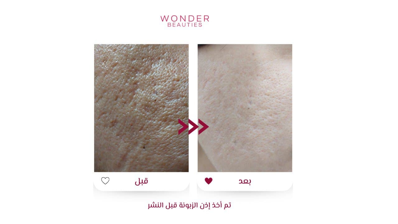 من صور اشتراك وندر للعناية