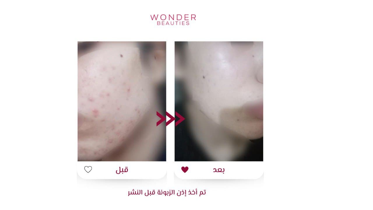 من صور اشتراك وندر للعناية