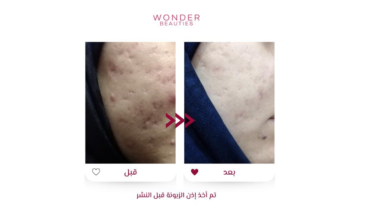 من صور اشتراك وندر للعناية