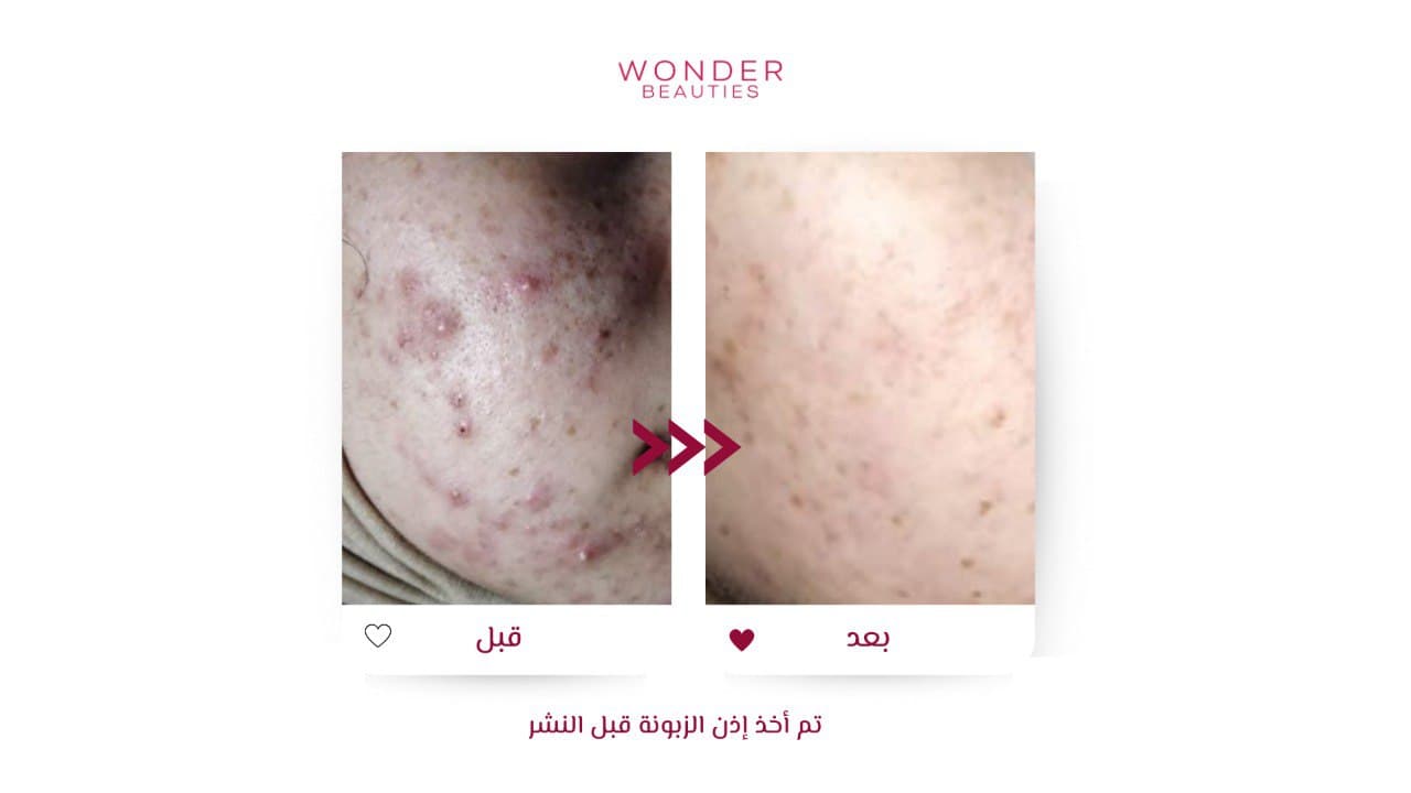 من صور اشتراك وندر للعناية